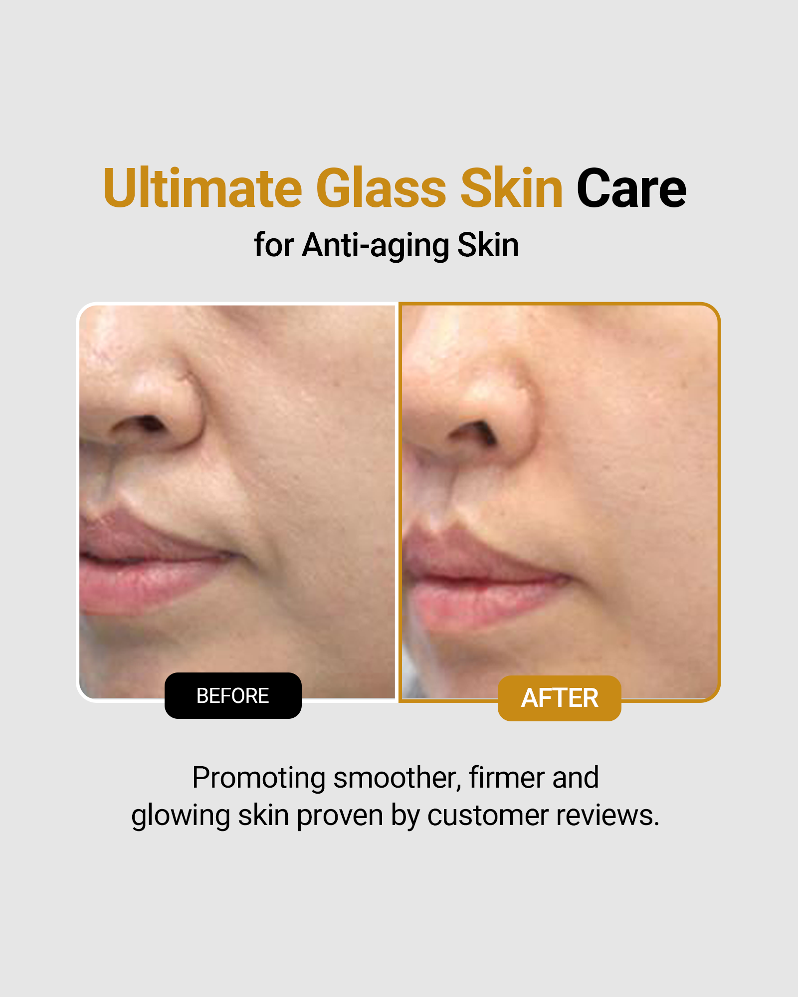 Collagen Boosting White Spicule Cream