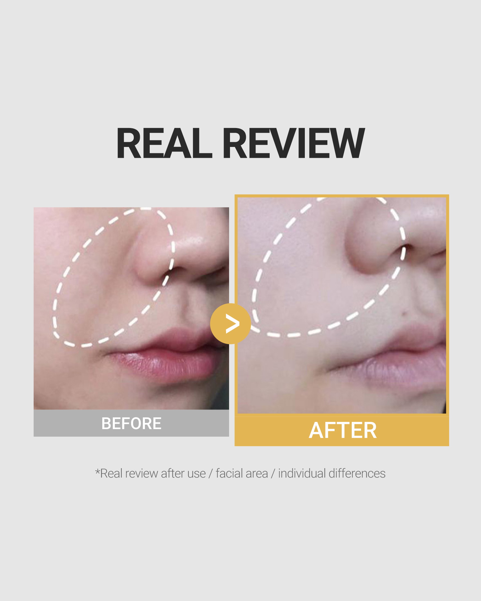 Deep Collagen Barrier Serum Mist