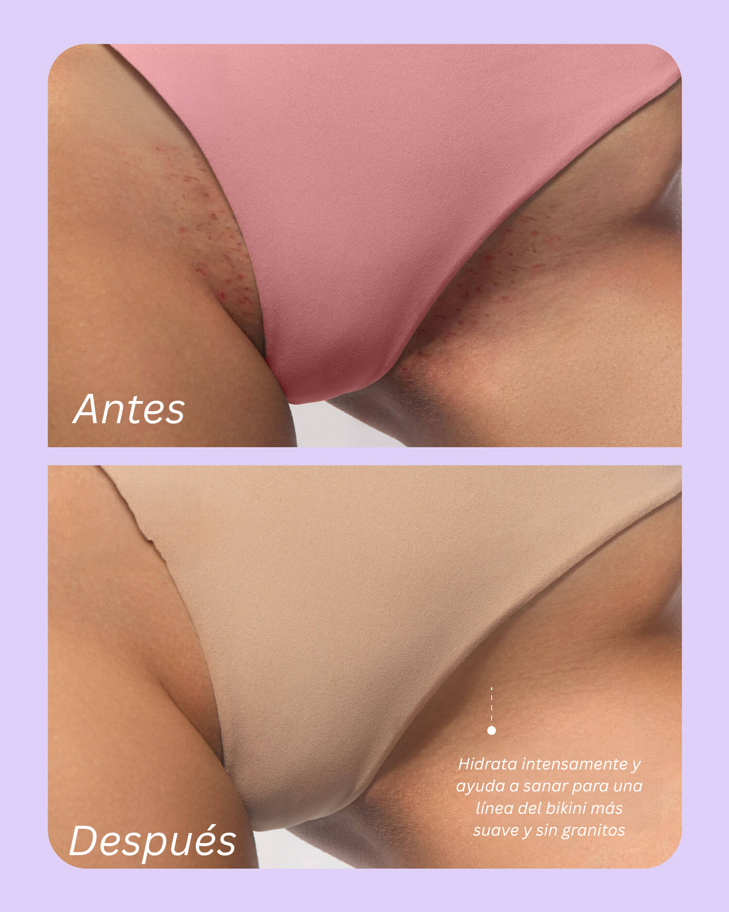 Merraci™ Aceite Post-Afeitado – Brillo Suave y Piel Hidratada